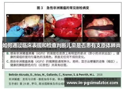如何通过临床表现和检查判断儿童是否患有支原体肺炎